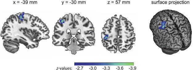 Transkranielle Wechselstromstimulation
